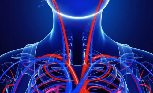 МР-ангиография артерий и сосудов шеи